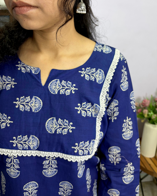 Women's Printed Pure Cotton Short Kurti for Everyday Casual and Festive